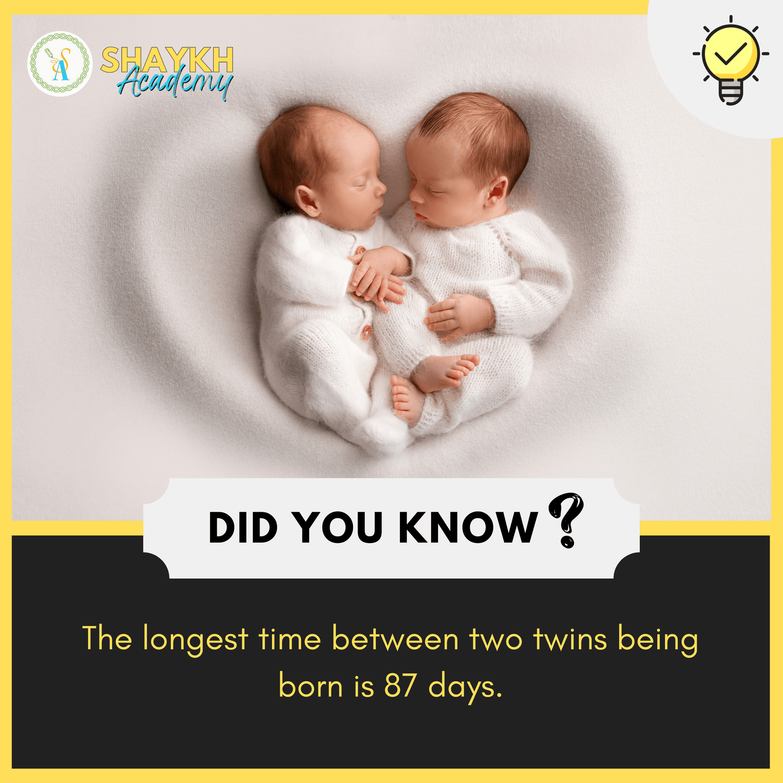 The longest time between two twins being born is 87 days